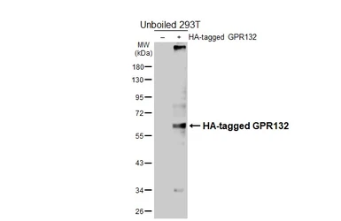 Anti-GPR132 antibody [HL4946] used in Western Blot (WB). GTX645019
