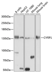 Anti-CYFIP1 antibody used in Western Blot (WB). GTX64502