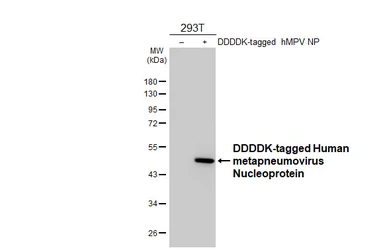 Anti-Human metapneumovirus Nucleoprotein antibody [GT298] used in Western Blot (WB). GTX645024