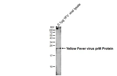Anti-Yellow Fever virus prM Protein antibody [GT299] used in Western Blot (WB). GTX645025