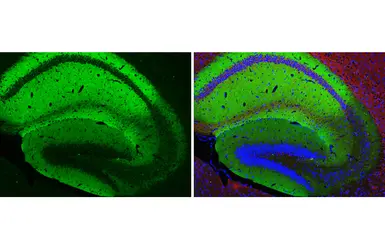 Anti-GluR1 antibody [GT301] used in IHC (Paraffin sections) (IHC-P). GTX645027