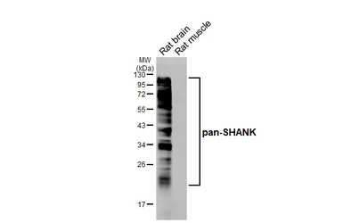 Anti-pan-SHANK antibody [GT302] used in Western Blot (WB). GTX645028