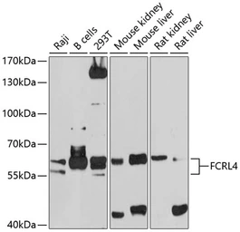 Anti-IRTA1 antibody used in Western Blot (WB). GTX64503