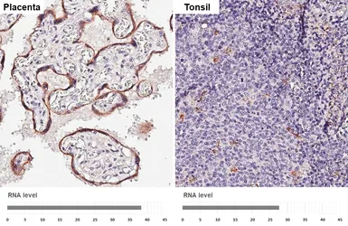 Anti-GBA antibody [HL4952] used in IHC (Paraffin sections) (IHC-P). GTX645038