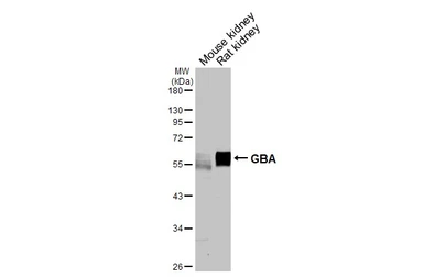 Anti-GBA antibody [HL4952] used in Western Blot (WB). GTX645038