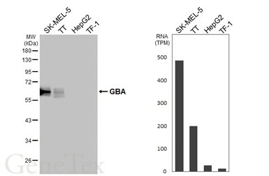 Anti-GBA antibody [HL4952] used in Western Blot (WB). GTX645038