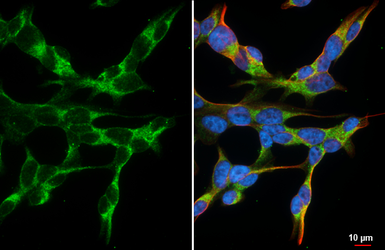 Anti-GBA antibody [HL4952] used in Immunocytochemistry/ Immunofluorescence (ICC/IF). GTX645038