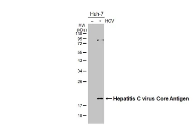 Anti-Hepatitis C virus Core Antigen antibody [HL4956] used in Western Blot (WB). GTX645042