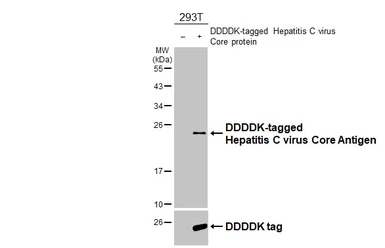 Anti-Hepatitis C virus Core Antigen antibody [HL4956] used in Western Blot (WB). GTX645042
