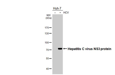 Anti-Hepatitis C virus NS3 protein antibody [HL4959] used in Western Blot (WB). GTX645045