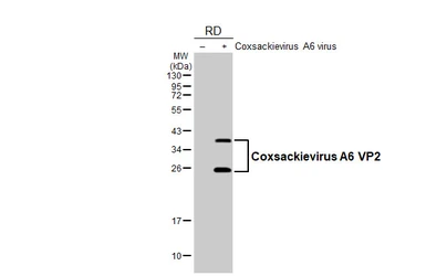 Anti-Coxsackievirus A6 VP2 antibody [HL4965] used in Western Blot (WB). GTX645051