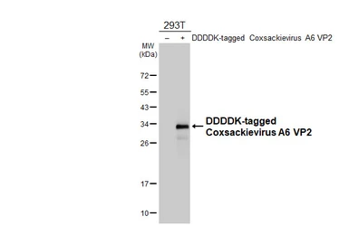 Anti-Coxsackievirus A6 VP2 antibody [HL4965] used in Western Blot (WB). GTX645051