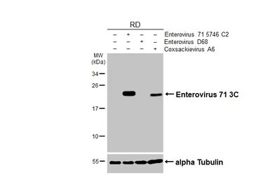 Anti-Enterovirus 71 3C antibody [HL4973] used in Western Blot (WB). GTX645059