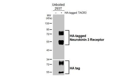 Anti-Neurokinin 3 Receptor antibody [HL4983] used in Western Blot (WB). GTX645069