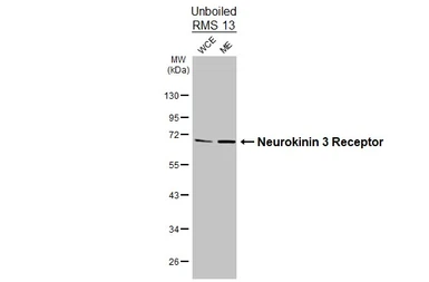 Anti-Neurokinin 3 Receptor antibody [HL4983] used in Western Blot (WB). GTX645069