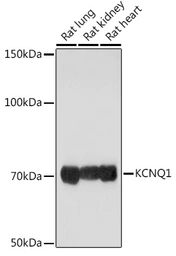 Anti-KCNQ1 antibody used in Western Blot (WB). GTX64507