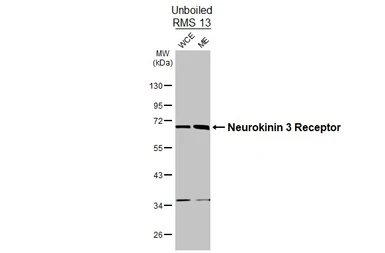 Anti-Neurokinin 3 Receptor antibody [HL4985] used in Western Blot (WB). GTX645071