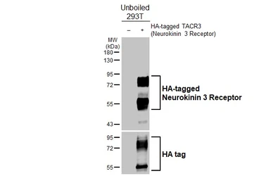 Anti-Neurokinin 3 Receptor antibody [HL4985] used in Western Blot (WB). GTX645071