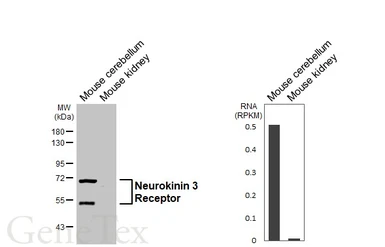 Anti-Neurokinin 3 Receptor antibody [HL4985] used in Western Blot (WB). GTX645071