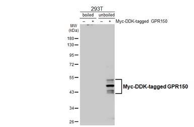 Anti-GPR150 antibody [HL4986] used in Western Blot (WB). GTX645072
