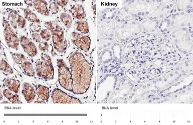 Anti-RAB27B antibody [HL4987] used in IHC (Paraffin sections) (IHC-P). GTX645073