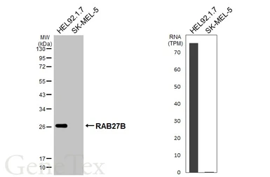 Anti-RAB27B antibody [HL4987] used in Western Blot (WB). GTX645073