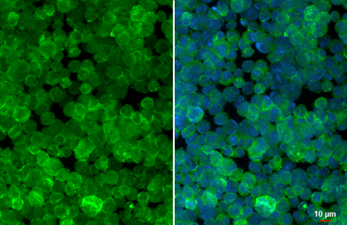 Anti-RAB27B antibody [HL4987] used in Immunocytochemistry/ Immunofluorescence (ICC/IF). GTX645073