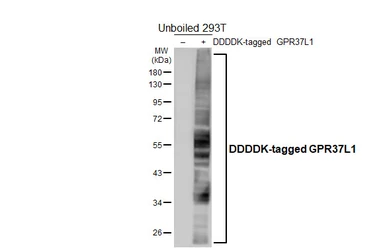 Anti-GPR37L1 antibody [HL4988] used in Western Blot (WB). GTX645074