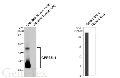 Anti-GPR37L1 antibody [HL4988] used in Western Blot (WB). GTX645074
