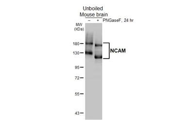 Anti-NCAM antibody [HL4992] used in Western Blot (WB). GTX645078