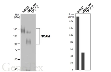 Anti-NCAM antibody [HL4992] used in Western Blot (WB). GTX645078