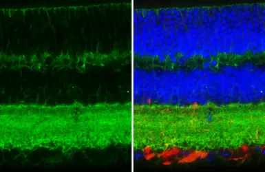 Anti-NCAM antibody [HL4992] used in IHC (Paraffin sections) (IHC-P). GTX645078