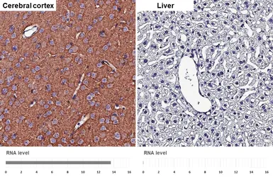 Anti-NCAM antibody [HL4992] used in IHC (Paraffin sections) (IHC-P). GTX645078