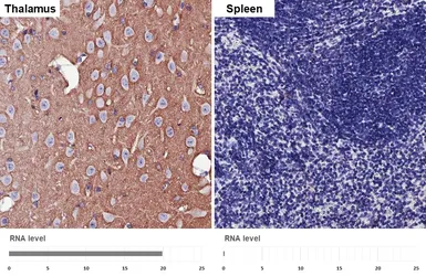 Anti-NCAM antibody [HL4992] used in IHC (Paraffin sections) (IHC-P). GTX645078