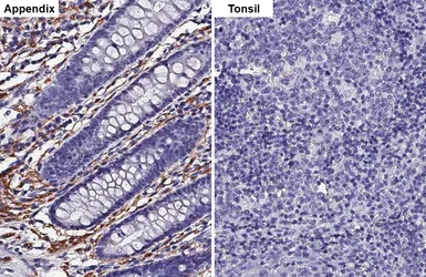 Anti-NCAM antibody [HL4992] used in IHC (Paraffin sections) (IHC-P). GTX645078
