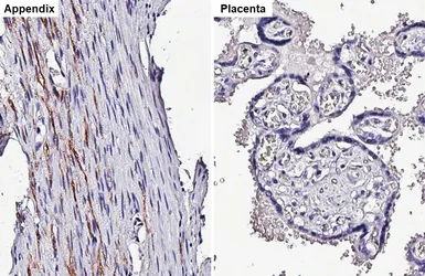 Anti-NCAM antibody [HL4992] used in IHC (Paraffin sections) (IHC-P). GTX645078