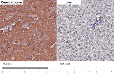 Anti-NCAM antibody [HL4992] used in IHC (Paraffin sections) (IHC-P). GTX645078