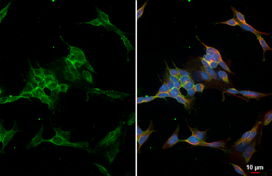 Anti-NCAM antibody [HL4992] used in Immunocytochemistry/ Immunofluorescence (ICC/IF). GTX645078