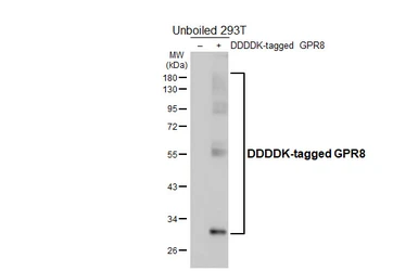 Anti-GPR8 antibody [HL4994] used in Western Blot (WB). GTX645080