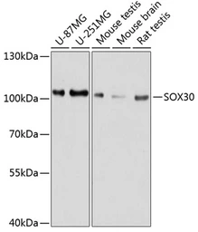 Anti-SOX30 antibody used in Western Blot (WB). GTX64509