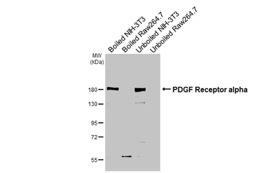 Anti-PDGF Receptor alpha antibody [HL5001] used in Western Blot (WB). GTX645094