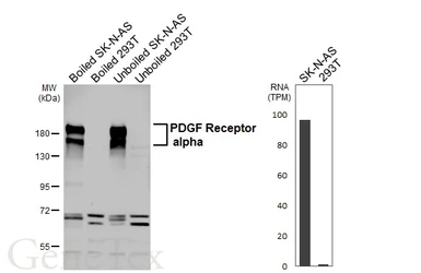Anti-PDGF Receptor alpha antibody [HL5001] used in Western Blot (WB). GTX645094
