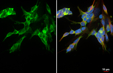 Anti-PDGF Receptor alpha antibody [HL5001] used in Immunocytochemistry/ Immunofluorescence (ICC/IF). GTX645094