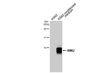Anti-NMU antibody [HL5007] used in Western Blot (WB). GTX645100