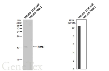 Anti-NMU antibody [HL5007] used in Western Blot (WB). GTX645100