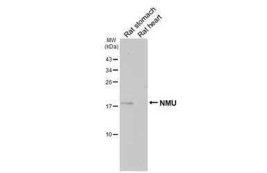 Anti-NMU antibody [HL5007] used in Western Blot (WB). GTX645100