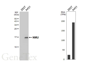 Anti-NMU antibody [HL5007] used in Western Blot (WB). GTX645100
