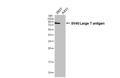 Anti-SV40 Large T-antigen antibody [HL5010] used in Western Blot (WB). GTX645103