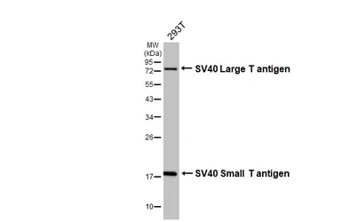 Anti-SV40 T-antigen antibody [HL5013] used in Western Blot (WB). GTX645106
