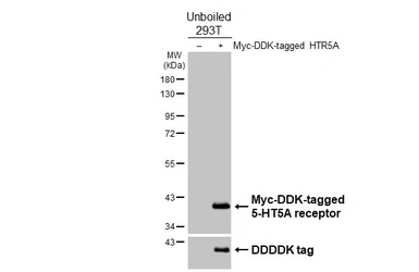 Anti-5-HT5A receptor antibody [HL5019] used in Western Blot (WB). GTX645112